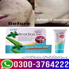 Acne Scar Gel Price in Pakistan